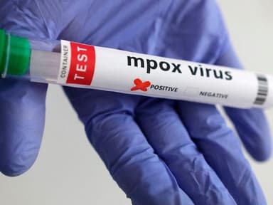 Sindh reports new mpox case as infections exceed 100 this year