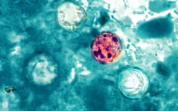 FDA investigates sixth Cyclospora outbreak with 72 cases identified FDA investigates sixth Cyclospora outbreak with 72 cases identified