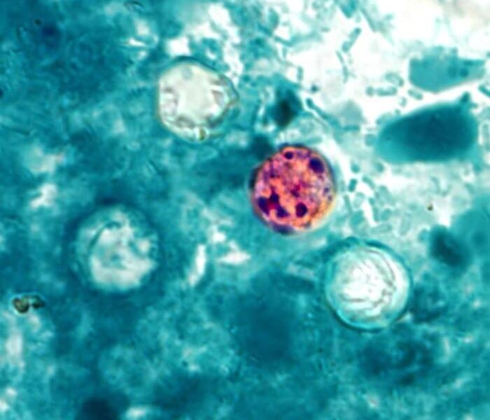 FDA investigates sixth Cyclospora outbreak with 72 cases identified FDA investigates sixth Cyclospora outbreak with 72 cases identified