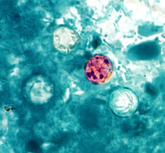 FDA investigates sixth Cyclospora outbreak with 72 cases identified