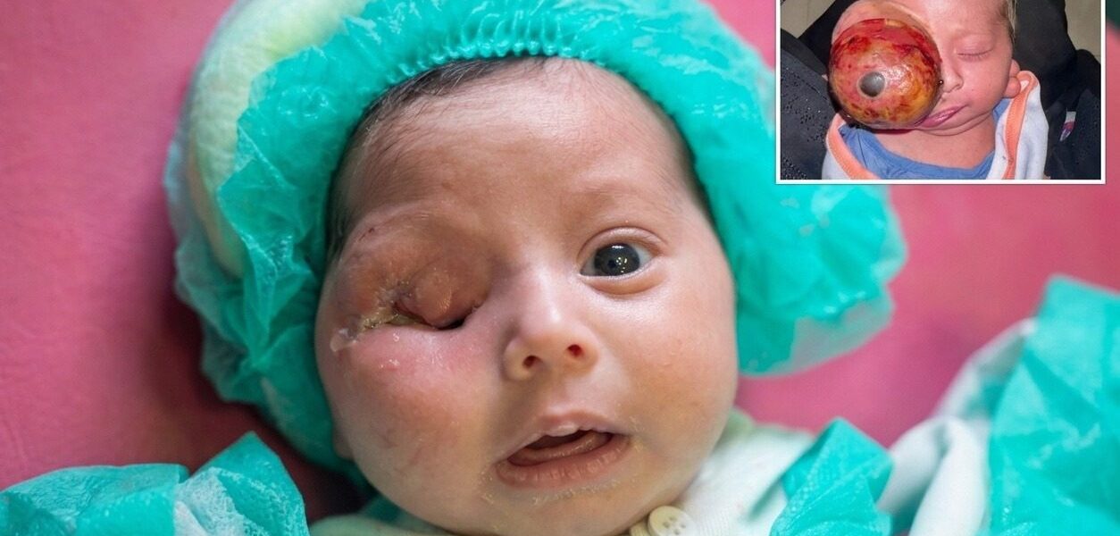 Al-Shifa doctors perform life-saving surgery on newborn Al-Shifa doctors perform life-saving surgery on newborn