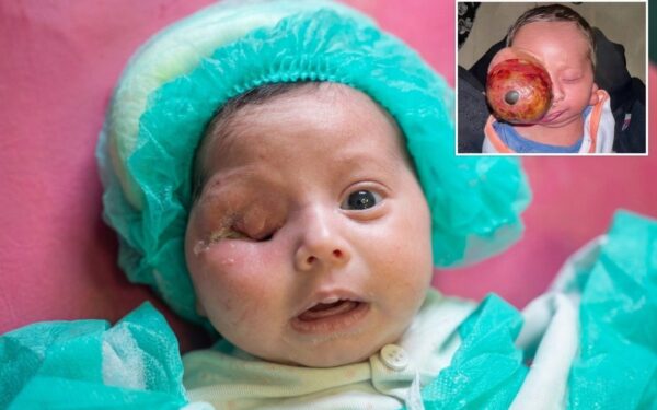 Al-Shifa doctors perform life-saving surgery on newborn Al-Shifa doctors perform life-saving surgery on newborn
