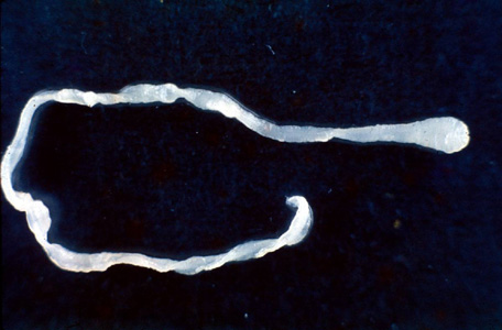 Doctors discover live 10-inch worm in man’s groin during routine surgery