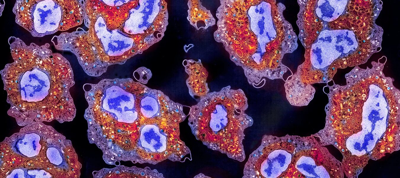 Study Shows Restoring Cell Removal Could Combat Age-Related Decline Study Shows Restoring Cell Removal Could Combat Age-Related Decline