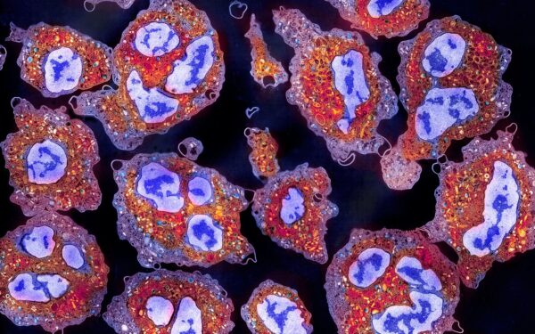 Study Shows Restoring Cell Removal Could Combat Age-Related Decline Study Shows Restoring Cell Removal Could Combat Age-Related Decline