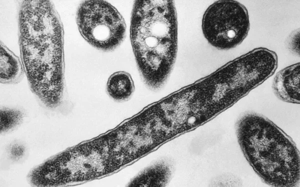New York outbreak highlights climate-linked legionnaires' disease New York outbreak highlights climate-linked legionnaires' disease