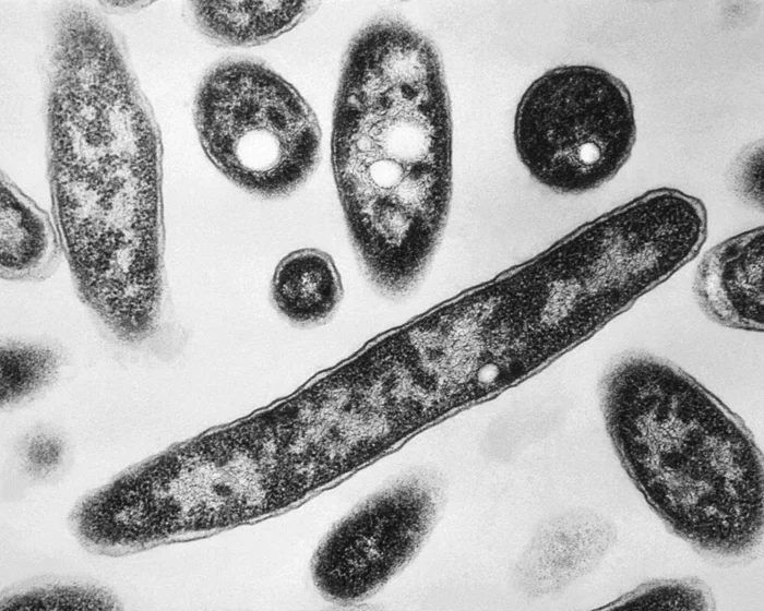 New York outbreak highlights climate-linked legionnaires' disease New York outbreak highlights climate-linked legionnaires' disease