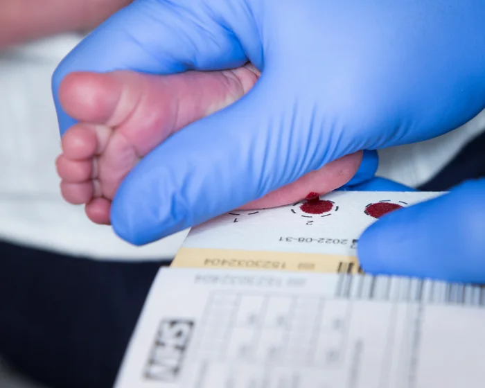 England to Screen All Newborns for Spinal Muscular Atrophy Starting Next Year