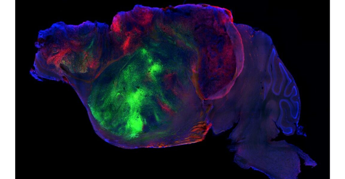Scientists Replace Mouse Brain Cells with Human Organoids Scientists Replace Mouse Brain Cells with Human Organoids