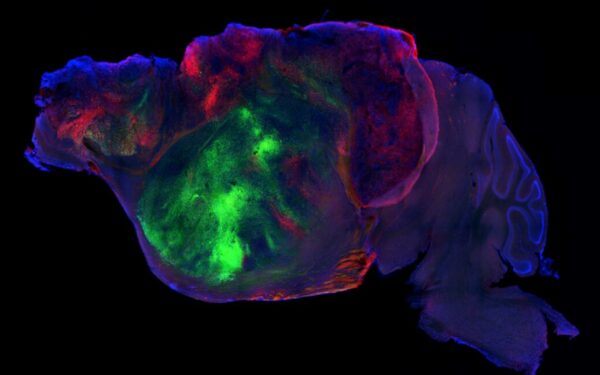 Scientists Replace Mouse Brain Cells with Human Organoids Scientists Replace Mouse Brain Cells with Human Organoids