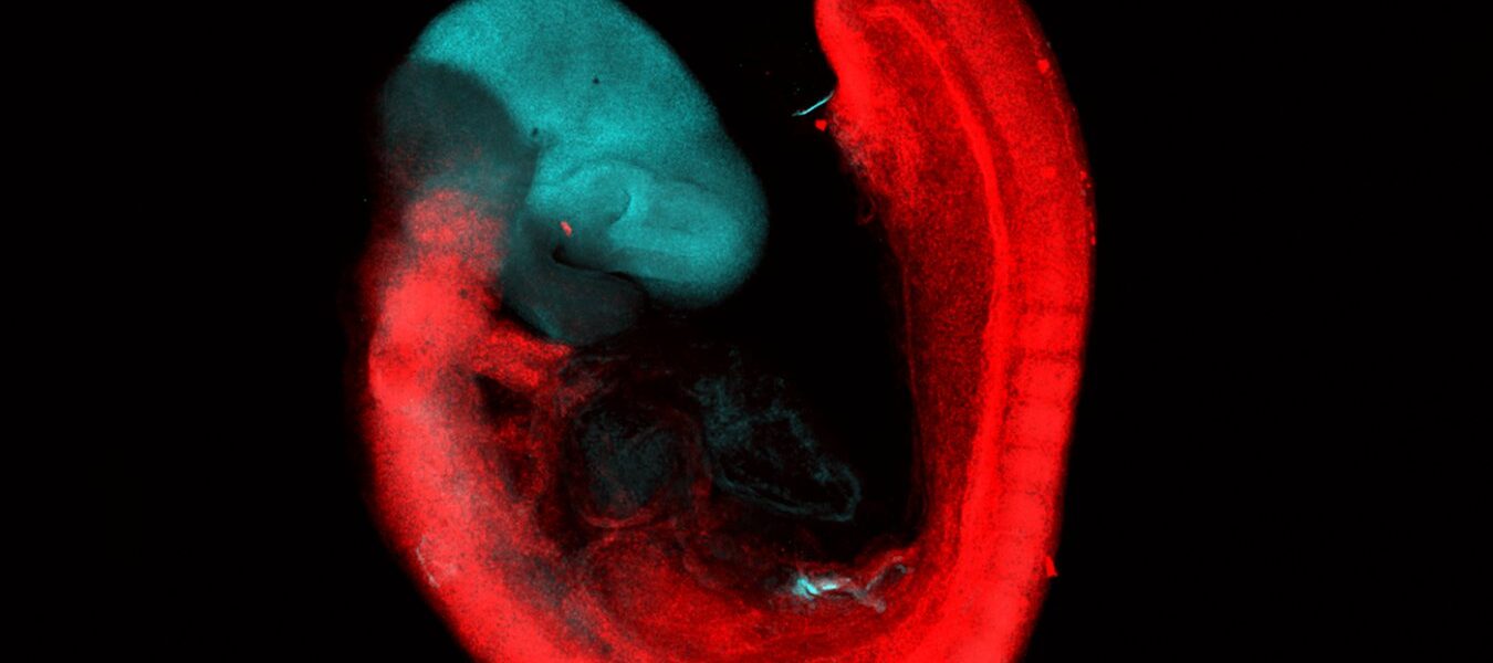 Human brain develops from two distinct cell types, study finds Human brain develops from two distinct cell types, study finds