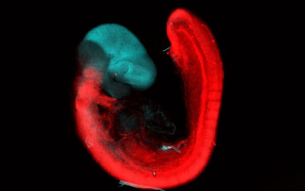 Human brain develops from two distinct cell types, study finds