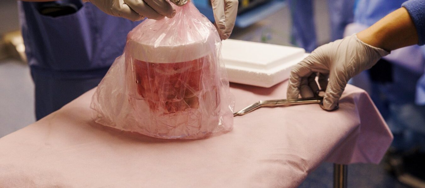 Genetically Modified Pig Kidney Keeps Man Off Dialysis for Nine Months Genetically Modified Pig Kidney Keeps Man Off Dialysis for Nine Months