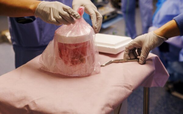 Genetically Modified Pig Kidney Keeps Man Off Dialysis for Nine Months Genetically Modified Pig Kidney Keeps Man Off Dialysis for Nine Months