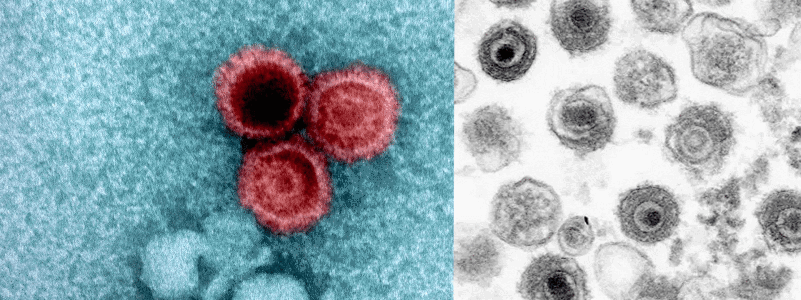 Scientists Create Antibody to Combat Widespread Virus