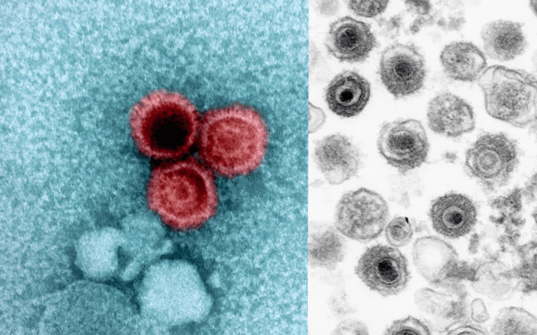 Scientists Create Antibody to Combat Widespread Virus Scientists Create Antibody to Combat Widespread Virus