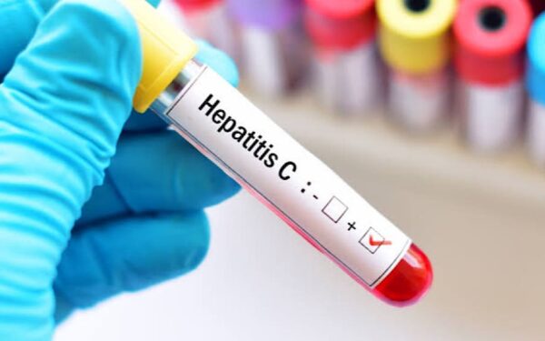 Finance Minister Urges Acceleration of Hepatitis C Screening Program Finance Minister Urges Acceleration of Hepatitis C Screening Program