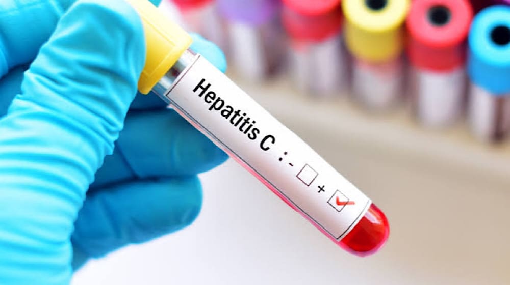 Finance Minister Urges Acceleration of Hepatitis C Screening Program