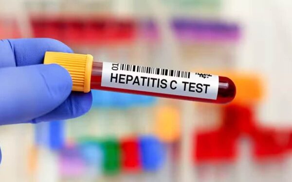 HEC Pledges Support for Free Hepatitis C Screening at Federal Universities HEC Pledges Support for Free Hepatitis C Screening at Federal Universities